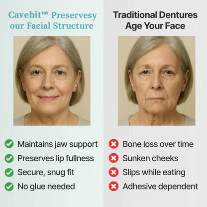 ✨Ends Today: 70% OFF! Cavebit™⏰ Custom-Fit Full Functional Dentures Make you more confident